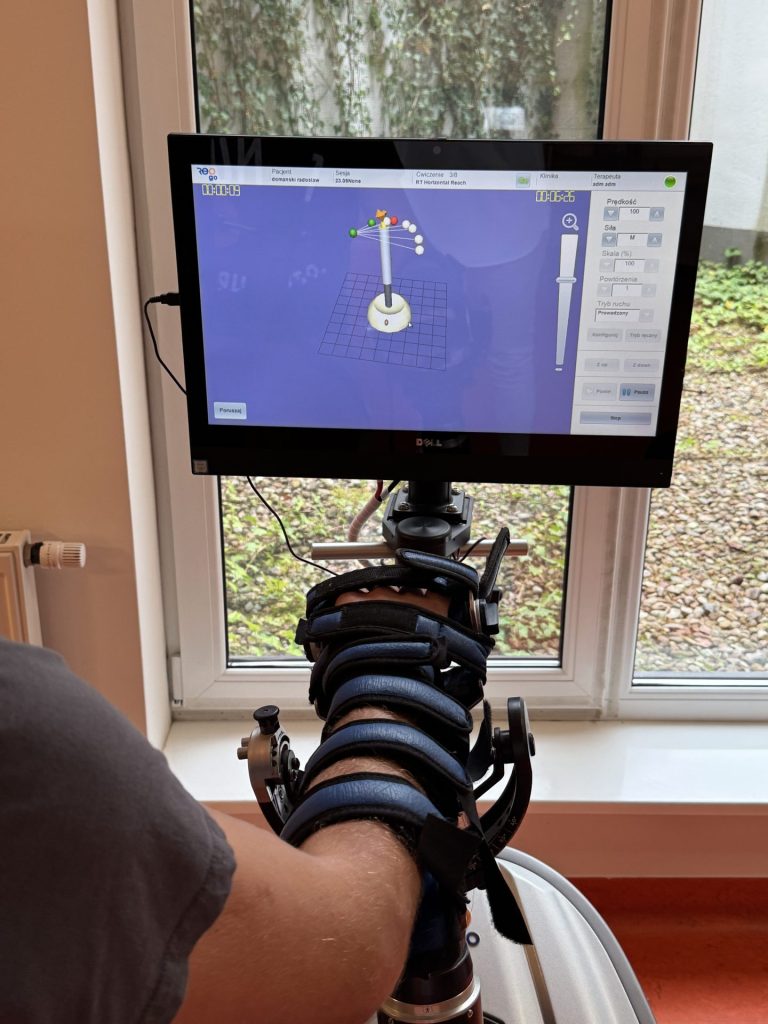 Robotyczna terapia ręki podczas rehabilitacji po udarze. Ramię pacjenta jest umieszczone w specjalistycznym urządzeniu wspomagającym ruch, a na ekranie monitora widoczny jest interaktywny program ćwiczeń służący do reedukacji funkcji kończyny górnej