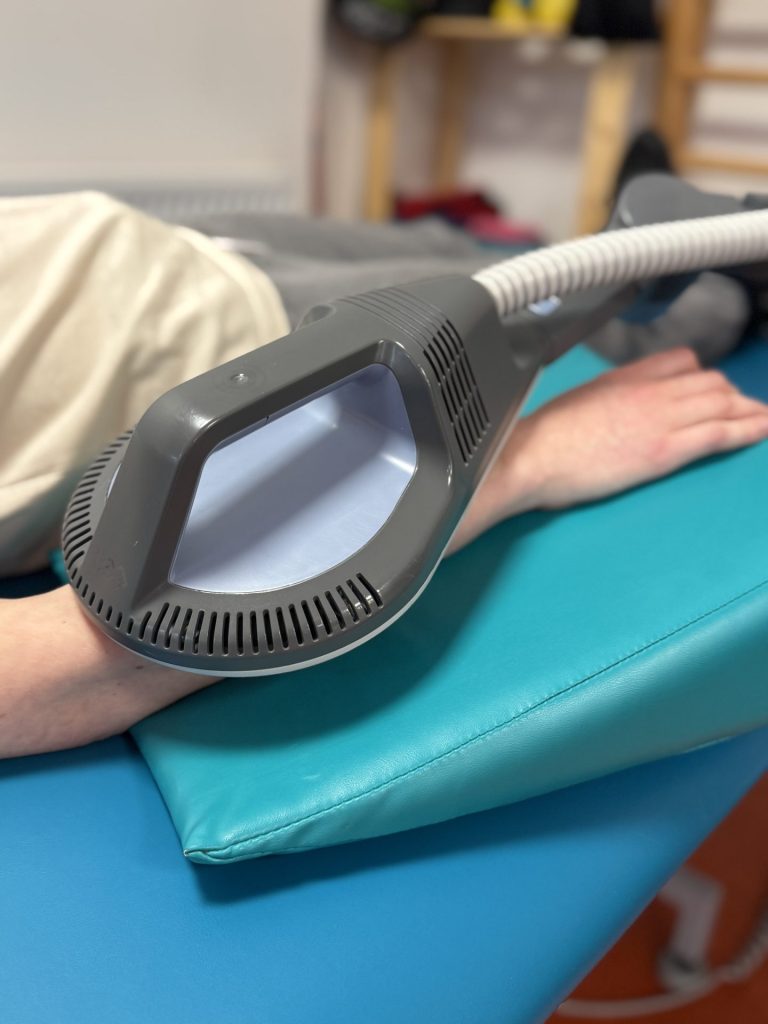 Terapia fizykalna podczas rehabilitacji po udarze. Przedramię pacjenta spoczywa na podkładzie terapeutycznym, a specjalistyczne urządzenie do terapii SIS jest skierowane na obszar wymagający stymulacji i redukcji bólu